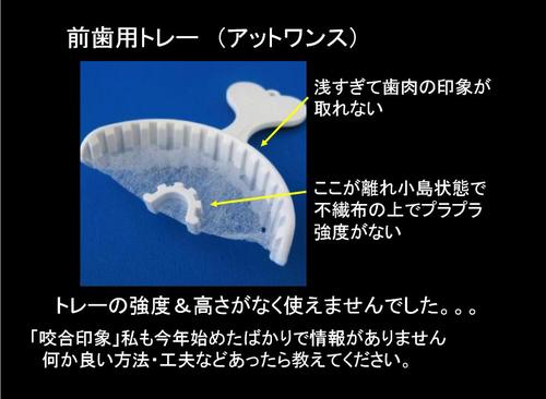 印象・咬合採得が同時にできる【咬合印象法】の手順 咬合印象用